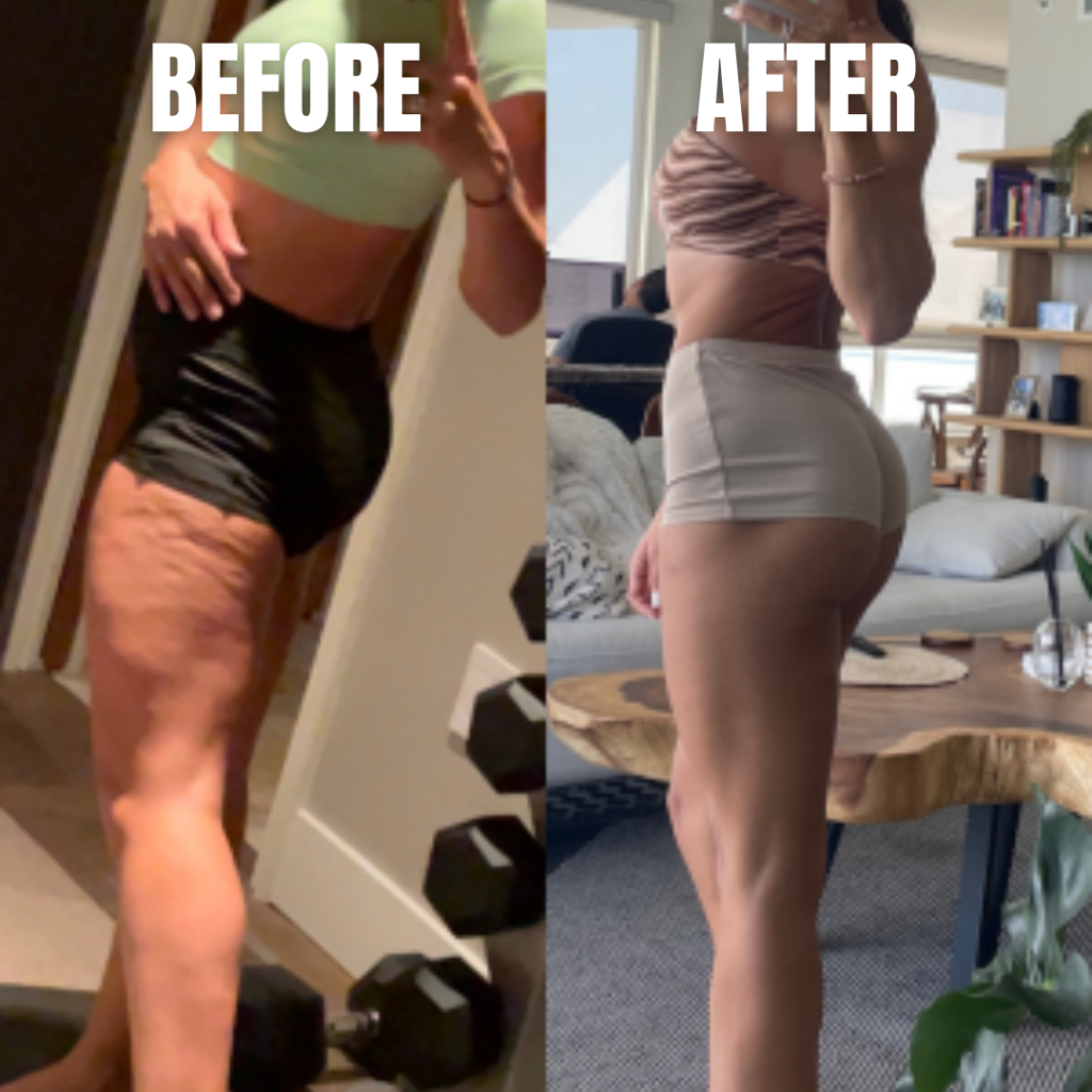 cosmo contour cellulite program
