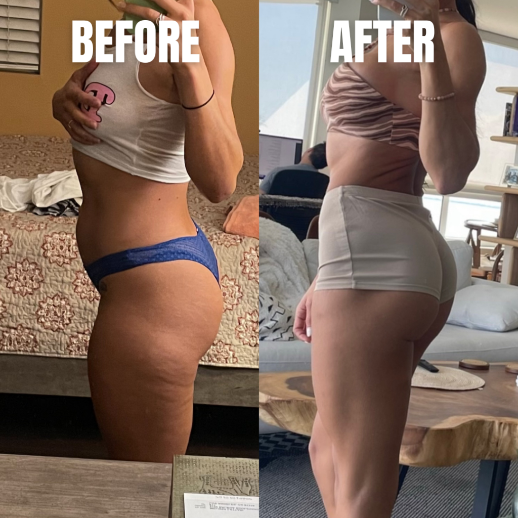cellulite program